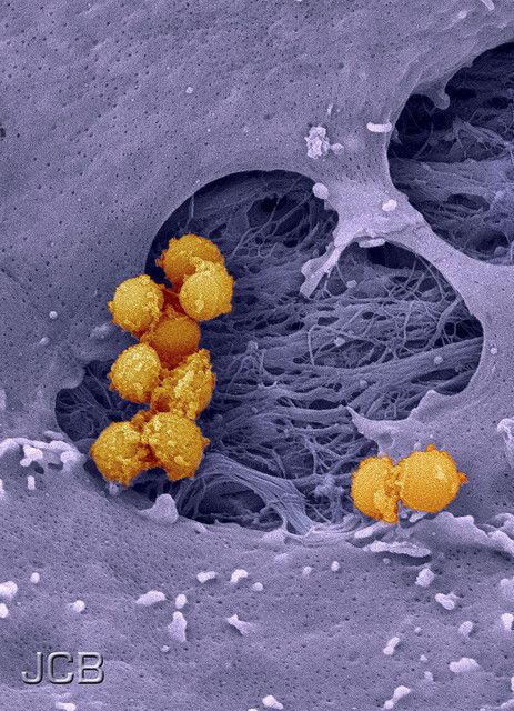 Staphylococcus aureus.