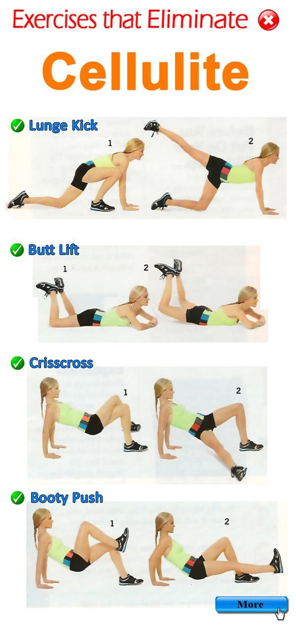 Cellulite – Gone: 5 Exercises To Reduce Cellulite And Burn Fat Off Your Thighs A