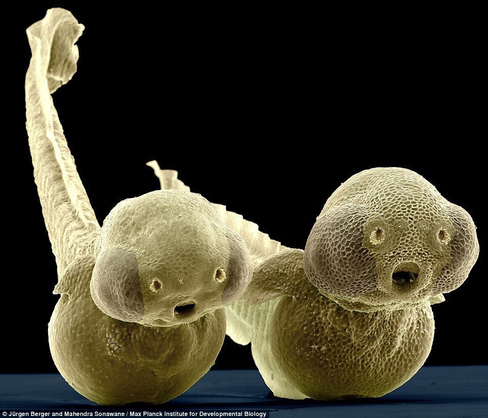 These odd-looking creatures are, in fact, two-day-old zebrafish larvae, as seen