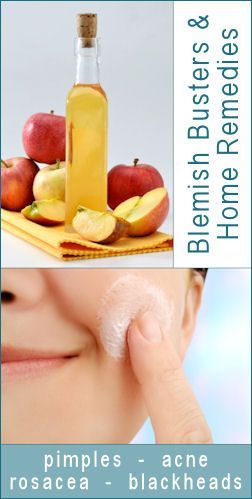at home remedies for blemishes