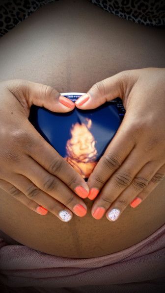 Maternity – Photography