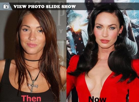 Megan Fox plastic surgery
