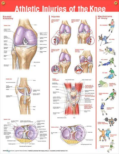Athletic Knee Injuries anatomy poster provides overview of normal knee anatomy a
