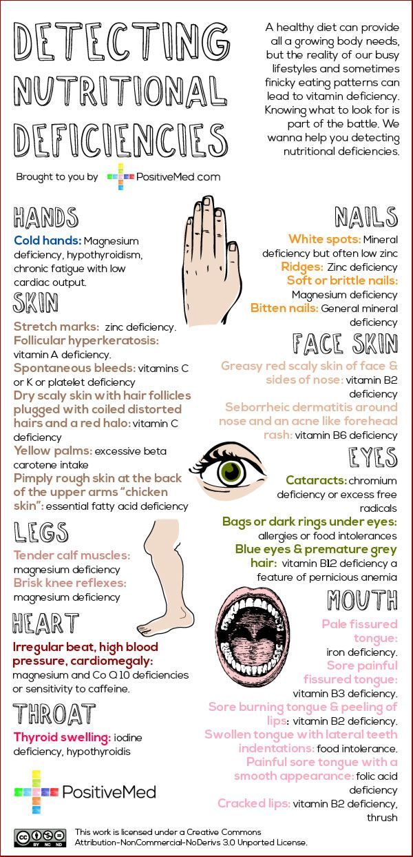 Deficiencies