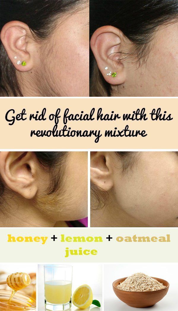 Get rid of facial hair with this revolutionary mixture