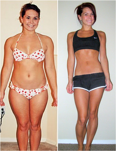 Legs | Before After Weight Loss Photos | Page 3