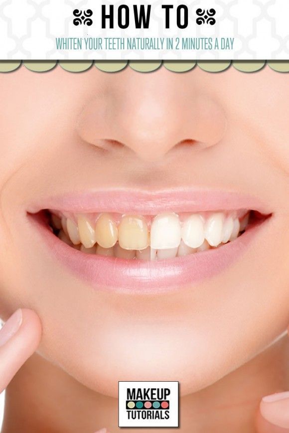 DIY Teeth Whitening | Whiten Teeth At Home Naturally by Makeup Tutorials at makeuptutorials.c…