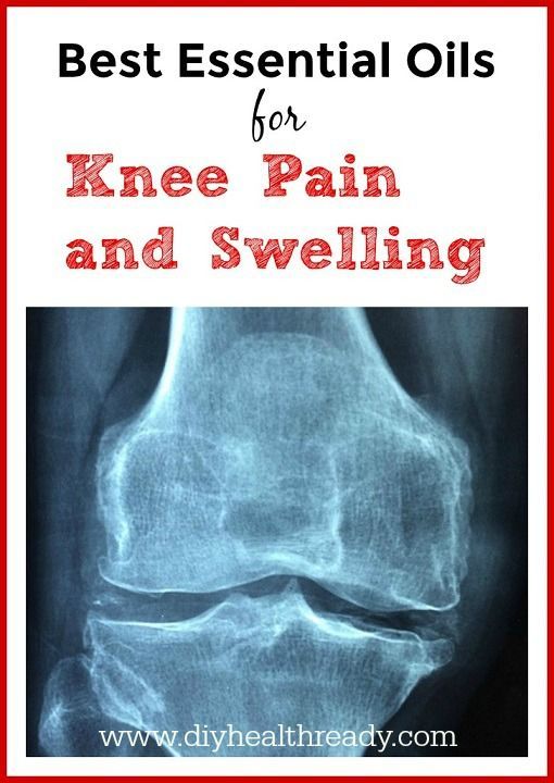 Its easy to learn how to use these best essential oils for knee pain and swel
