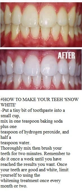 teeth whitening home remedy… Ok when I first saw this I thought no way, its gonn