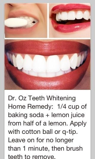 Teeth whitening