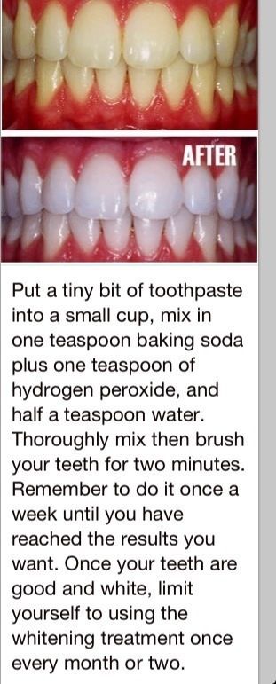 White teeth, this actually worked!!