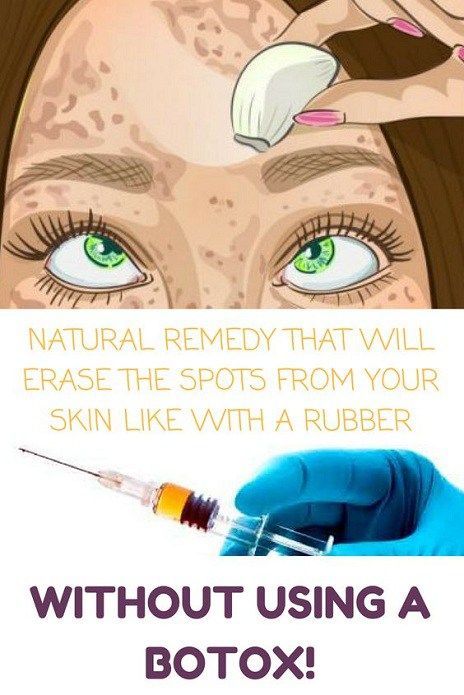 Erase the spots from your skin like with a rubber