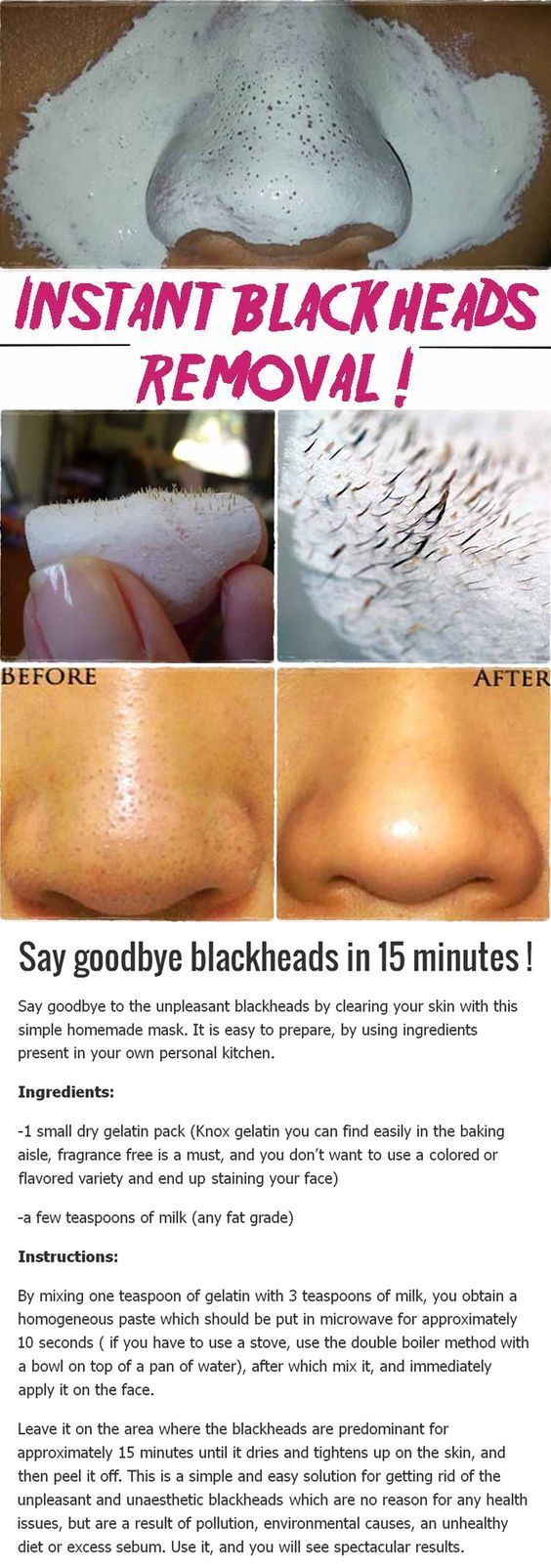 SAY GOODBYE BLACKHEADS IN 15 MINUTES