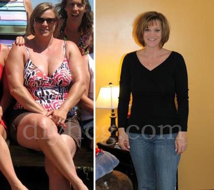 View the full story to this HCG diet before and after story and see TON of more pictures from people who did the HCG diet… amazing results! www.diyhcg.com -   22 hcg diet photos
 ideas