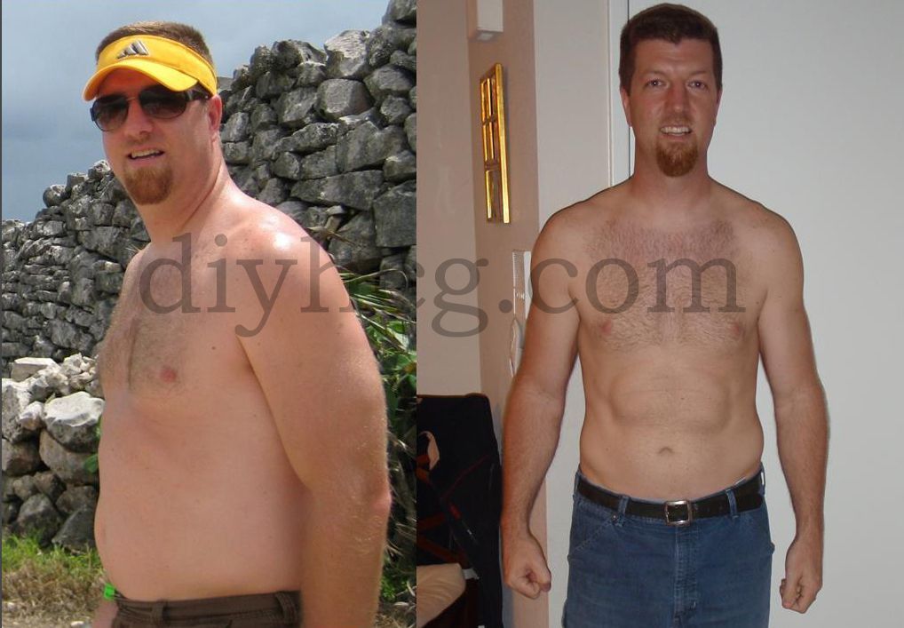 Read about Kent's amazing results with the HCG diet! He lost 40 pounds in 23 days! www.diyhcg.com -   22 hcg diet photos
 ideas