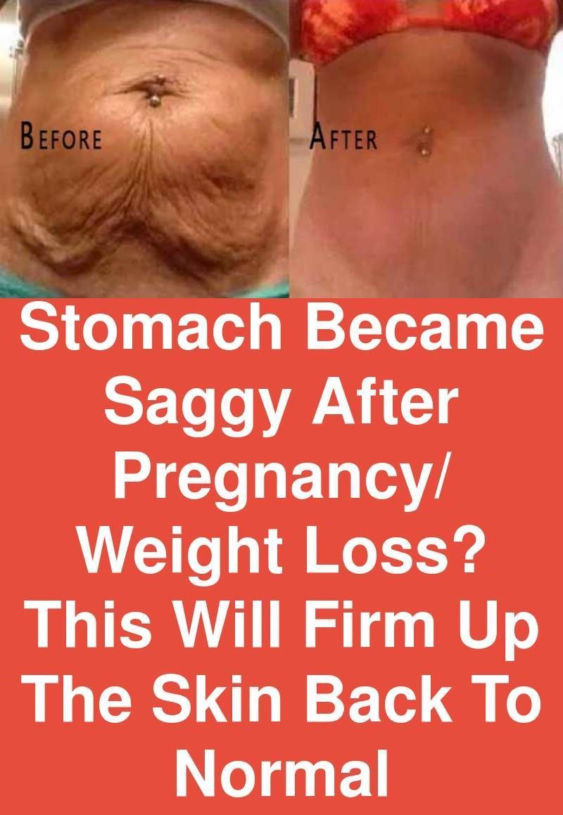 Stomach became saggy after pregnancy/ weight loss? This will firm up the skin back to normal -   17 fitness pregnancy weightloss
 ideas