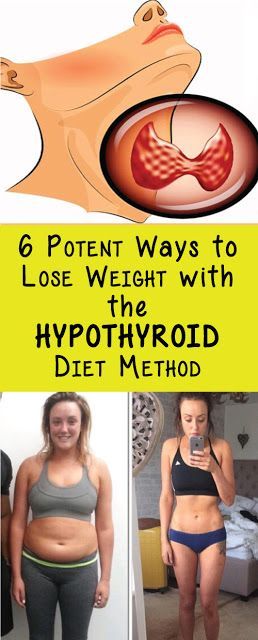 Here Are 6 Effective Ways To Lose Weight & The Hypothyroid Diet Method ~ KrobKnea -   22 medical diet weightloss
 ideas