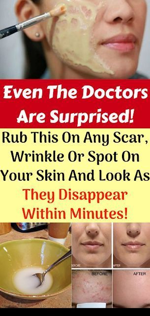 Rub This On Any Scar, Wrinkle Or Spot On Your Skin And Look As They Disappear Within Minutes! Even The Doctors Are Surprised! -   Health & Fitness