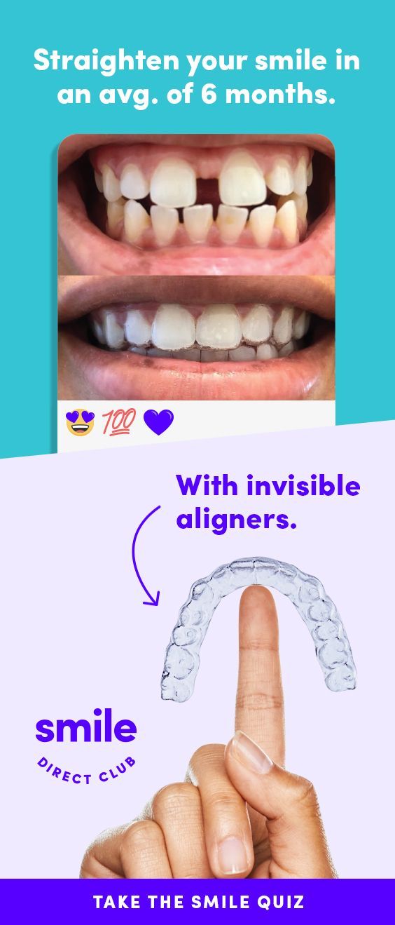 Take the free quiz to see how it works. Get your dream smile with invisible aligners for just $80/mo. -   11 hair Red faces
 ideas