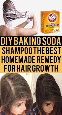 DIY Baking Soda Shampoo: The Best Homemade Remedy for Hair Growth -   20 hair Natural baking soda
 ideas