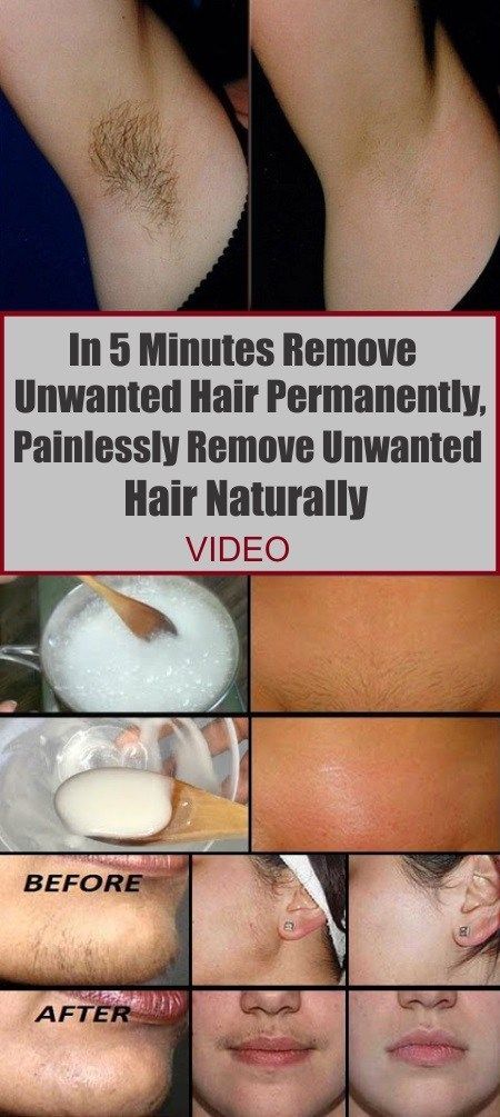 In 5 Minutes Remove Unwanted Hair Permanently, Painlessly Remove Unwanted Hair Naturally -   20 hair Natural baking soda
 ideas