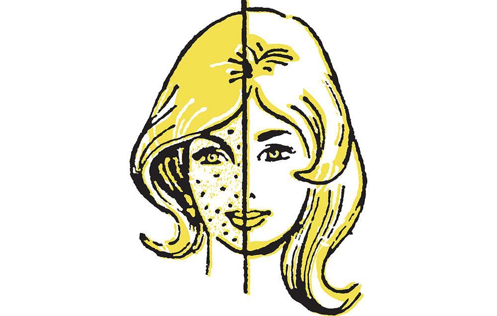 12 skin care Illustration acne treatment
 ideas