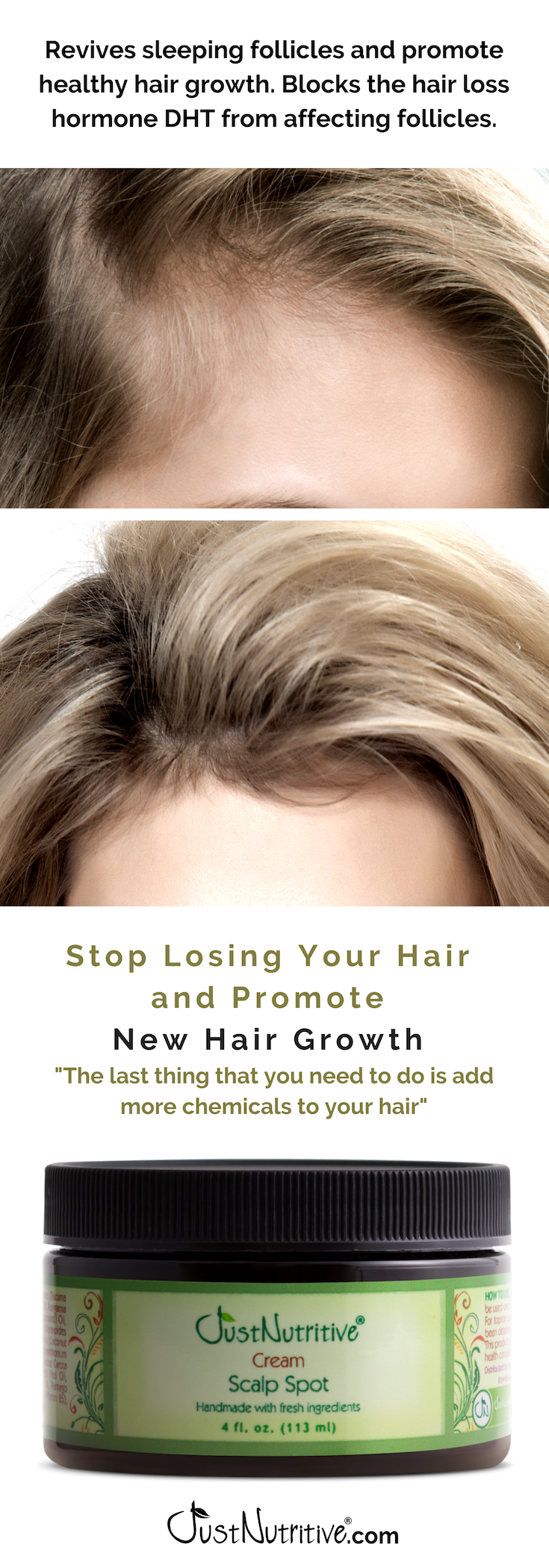Revives sleeping hair follicles! -   13 hair Growth bald spots
 ideas