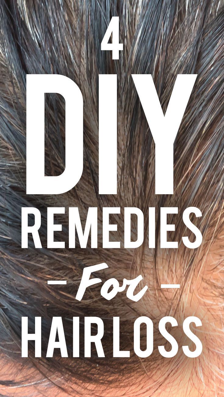 4 Diy Remedies For Quick Hair Loss Fixes -   12 hairstyles Quick healthy hair ideas