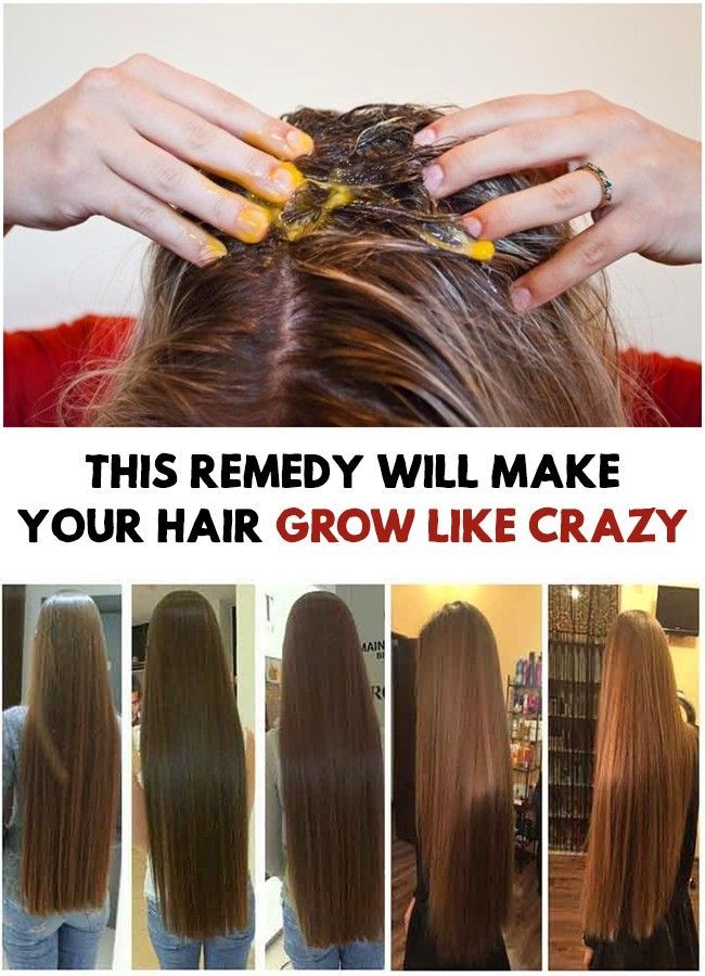 THIS REMEDY WILL MAKE YOUR HAIR GROW LIKE CRAZY -   12 long hair Treatment ideas