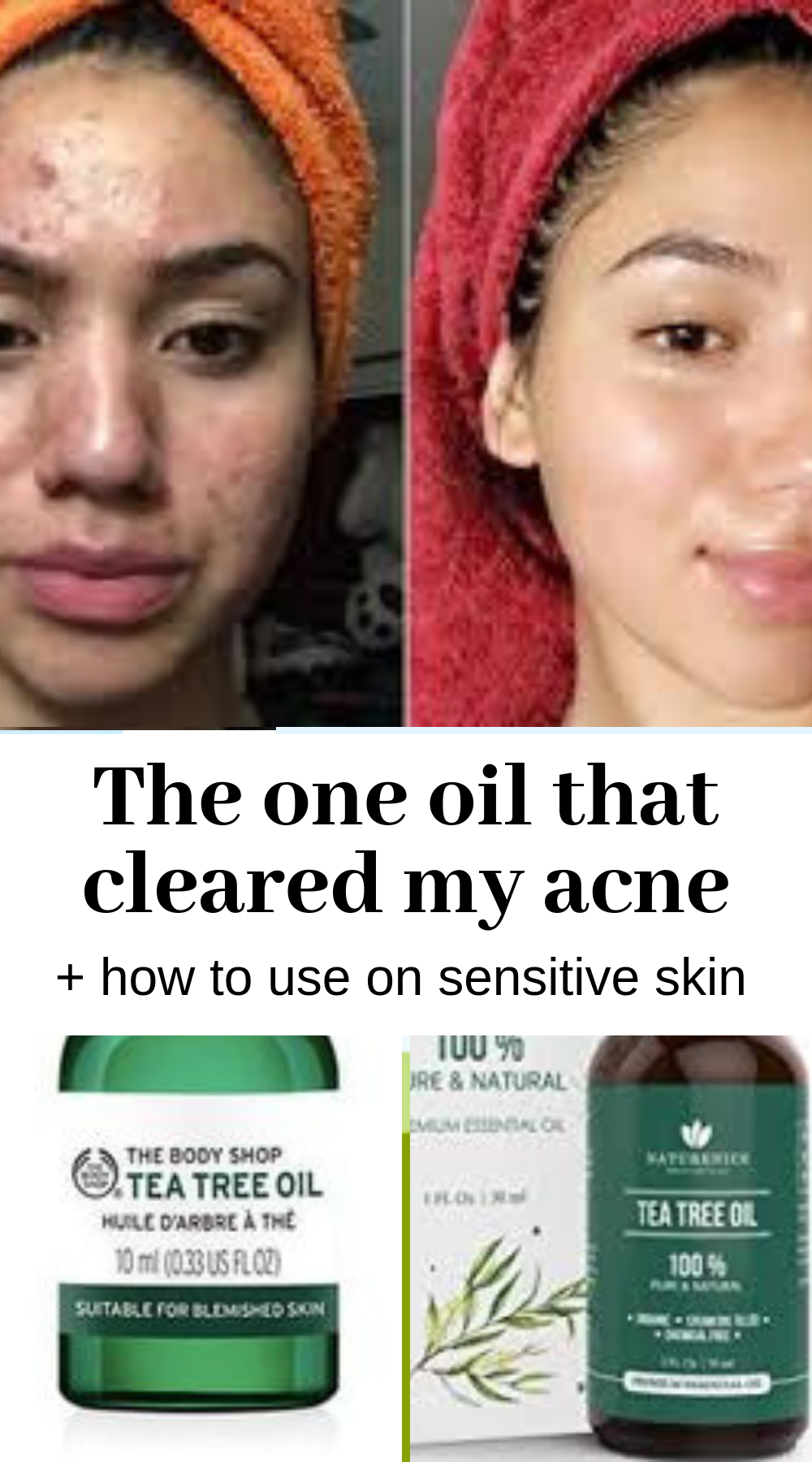 Use tea tree oil on acne, to get rid of pimples + Diy tea tree recipe: clear face tips -   13 skin care Acne tea tree ideas