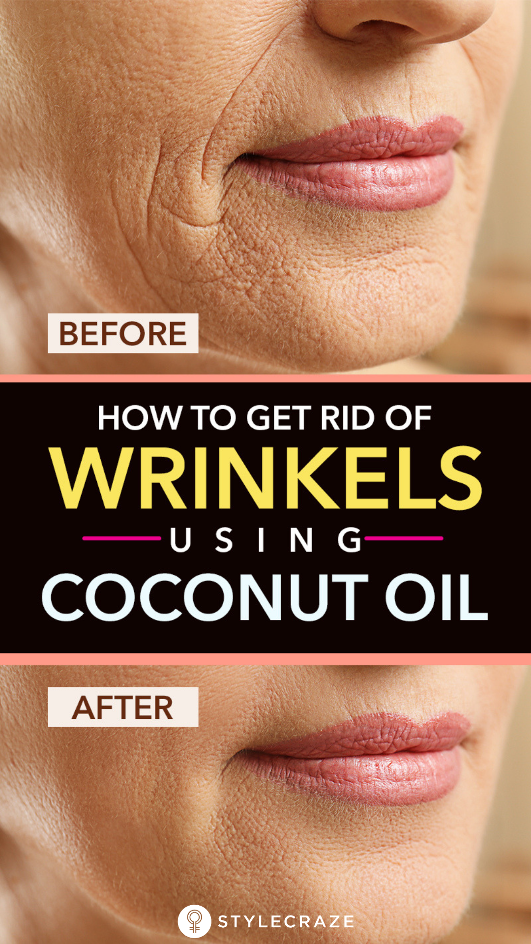How To Get Rid Of Wrinkles Using Coconut Oil -   13 skin care Coconut Oil faces ideas
