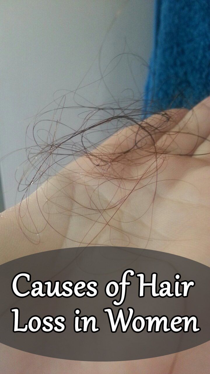 How To Stop And Reduce Hair Fall – 14 Things That Worked For Me -   17 thinning hair Women ideas