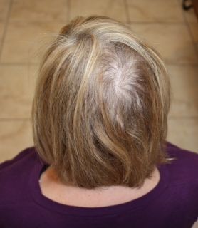 Best Products for Thinning Hair ~ From a Specialist!! (she: Kristy) -   17 thinning hair Women ideas