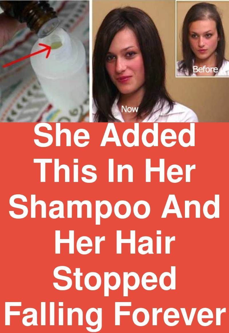 She added this in her shampoo and her hair stopped falling forever -   17 thinning hair Women ideas