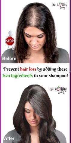 Prevent hair loss by adding these two ingredients to your shampoo! -   17 thinning hair Women ideas