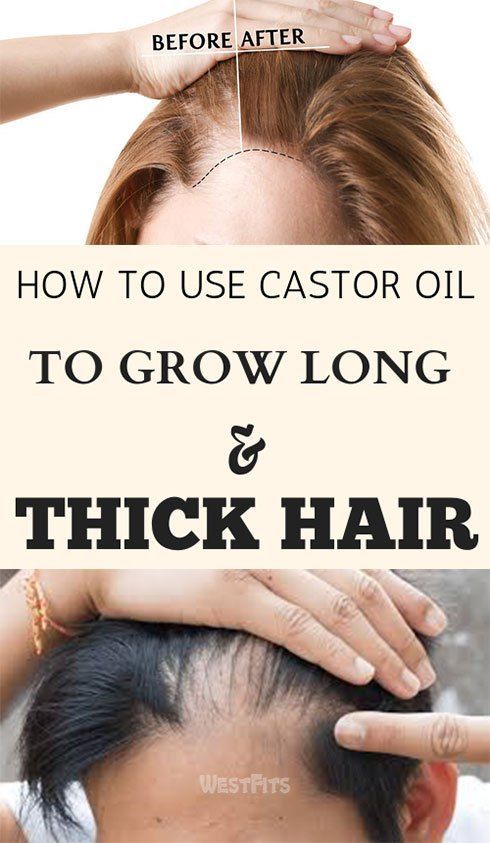 HOW TO USE CASTOR OIL TO GROW LONG, THICK HAIR -   17 thinning hair Women ideas