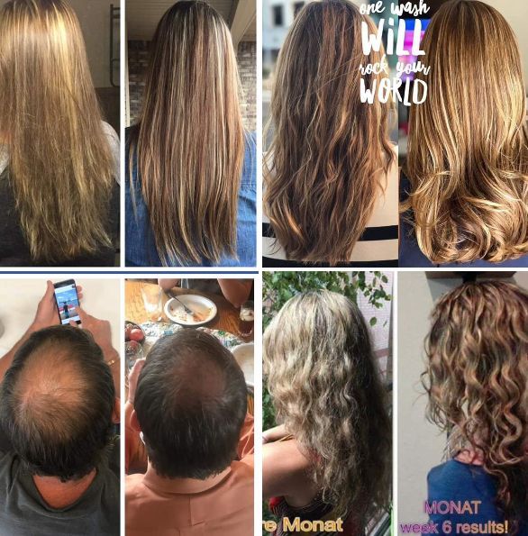 Monat Hair Care Solutions -   17 thinning hair Women ideas