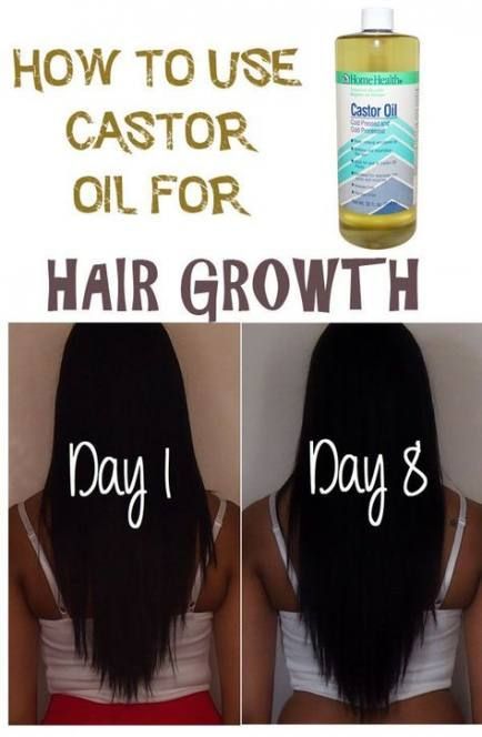 Hair Growth In A Year Vitamins 43+ Ideas -   12 hair Growth in a year ideas