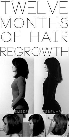 How to Grow Out Your Hair in One Year -   12 hair Growth in a year ideas