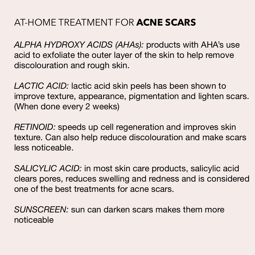 Treatment Products for Acne SCARS -   13 skin care Quotes acne scars ideas