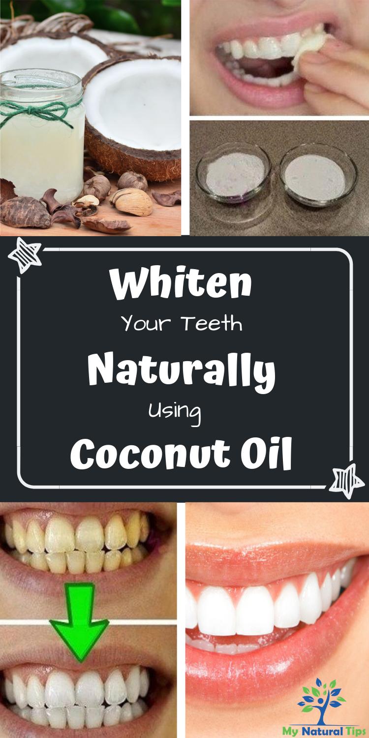 Research Finds That Coconut Oil Is Better Than Toothpaste - Start Using It -   10 fitness coconut oil ideas