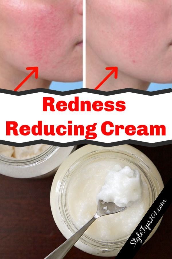 DIY Redness Reducing Cream -   11 skin care DIY redness ideas