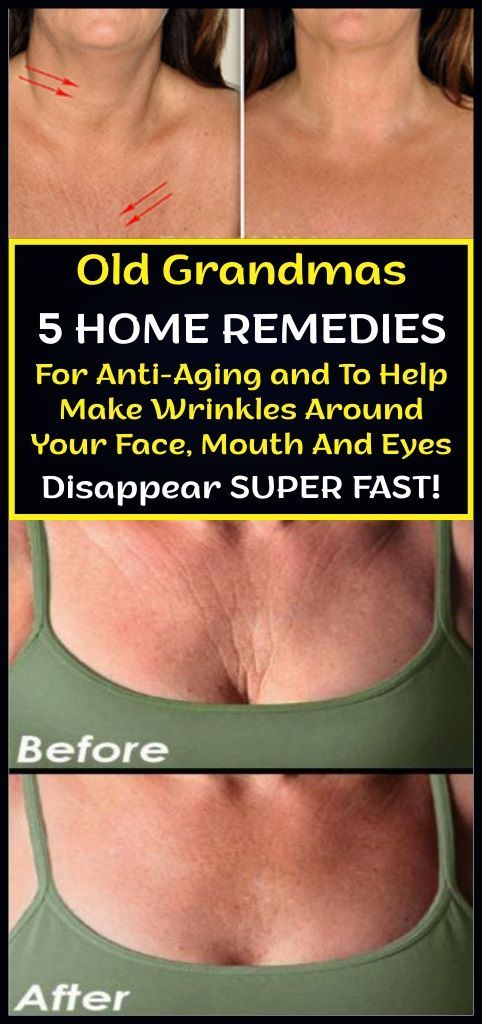 Old Grandmas 5 Home Remedies For Anti-Aging and To Help Make Wrinkles Around Your Face, Mouth And Eyes Disappear Super Fast -   15 skin care For Wrinkles products ideas
