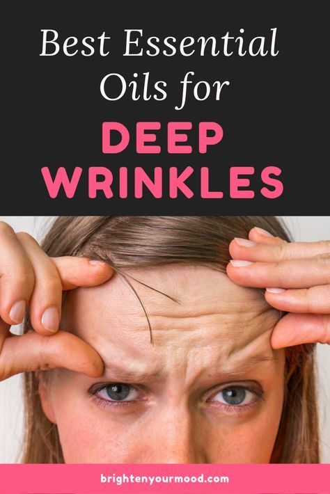 The Best Essential Oils for Deep Wrinkles in 2019 -   15 skin care For Wrinkles products ideas