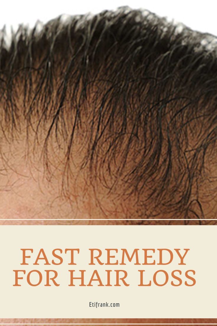 Fast remedy for hair loss -   15 hair Fall diy ideas