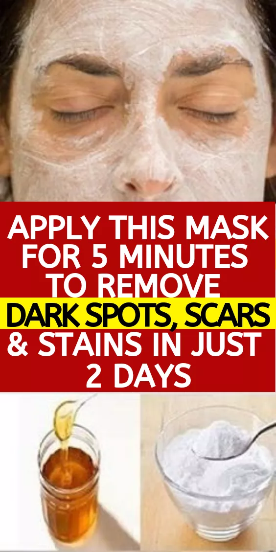 Homemade Face Mask To Remove Dark Spots, Scars & Stains In 2 Days -   14 skin care DIY scars ideas