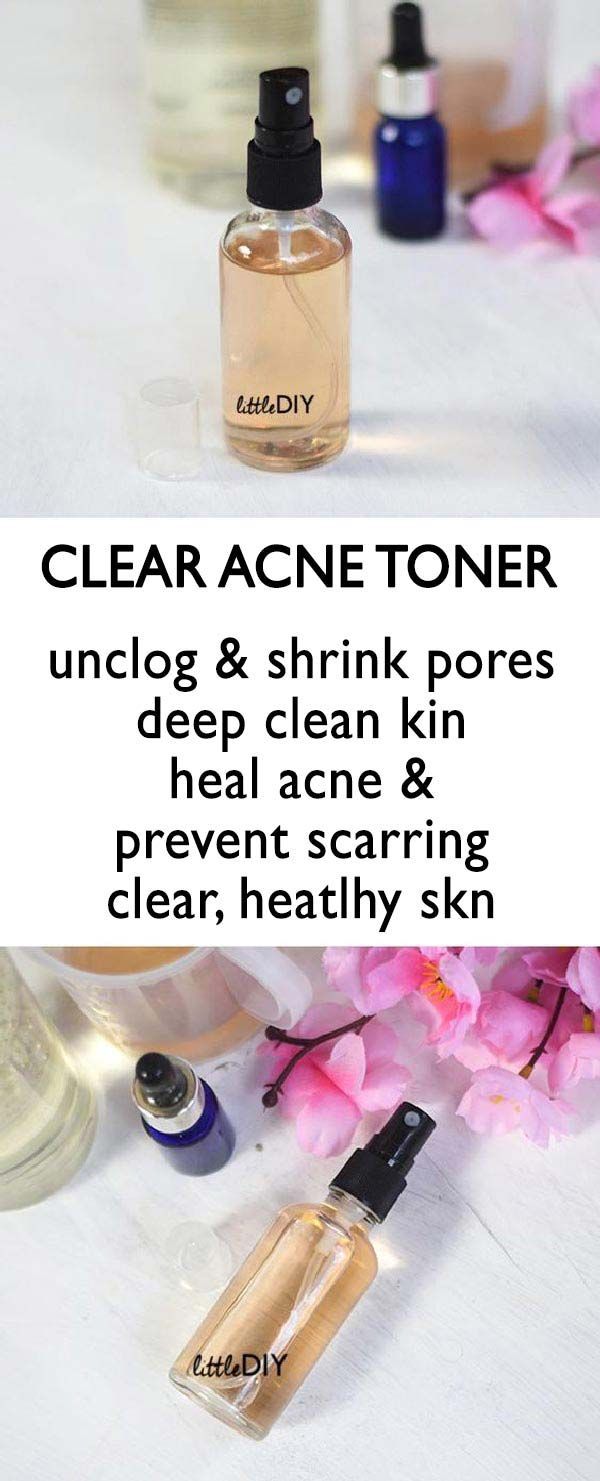 WITCH HAZEL TONER TO CLEAR UP YOUR SKIN FAST - LITTLE DIY -   17 skin care DIY witch hazel ideas
