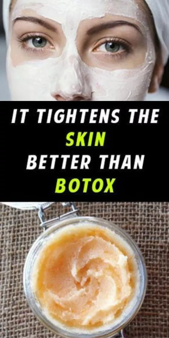 Skin Tightening Homemade Wrinkle Cream That Works Better Than Botox -   16 skin care Natural diy ideas