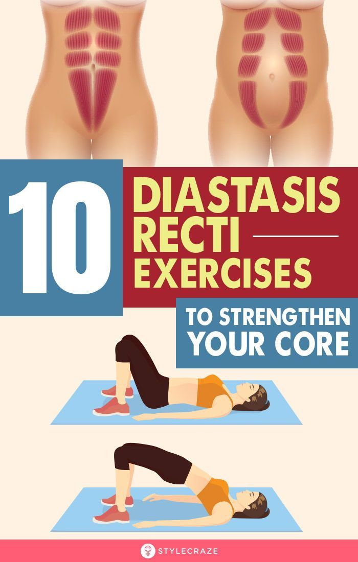 10 Best Diastasis Recti Exercises You Can Do At Home To Strengthen Your Core -   19 fitness Exercises beauty ideas