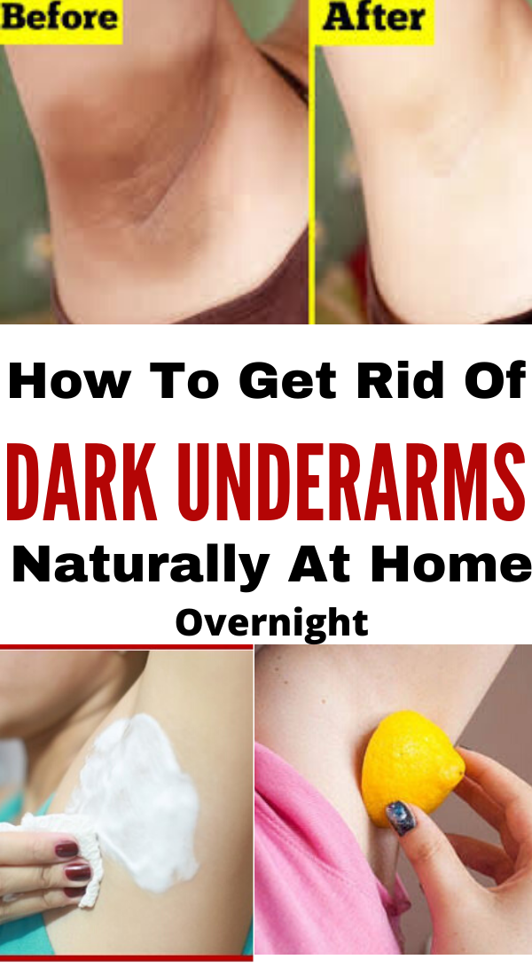 How to get rid of Dark underarms Naturally at home Overnight -   15 how to get rid of dark underarms ideas